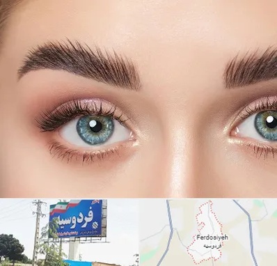 لیفت ابرو در فردوسیه شهریار