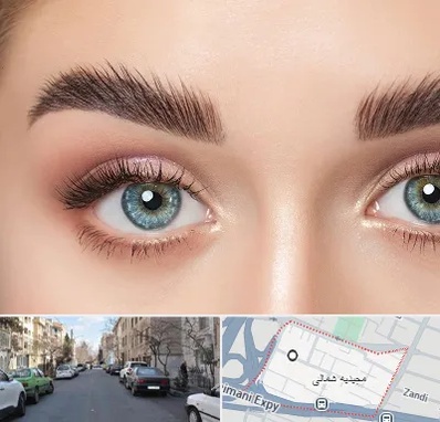 لیفت ابرو در مجیدیه شمالی