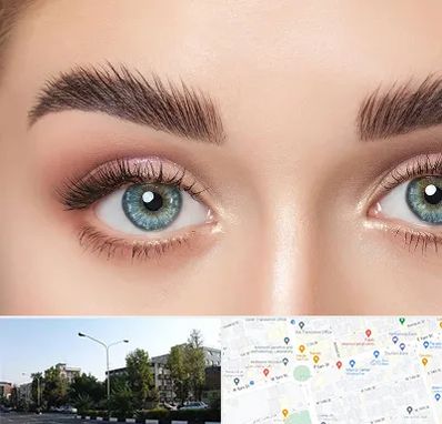 لیفت ابرو در میدان کاج