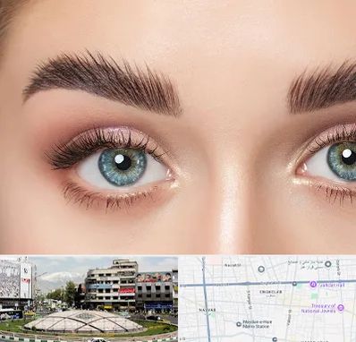 لیفت ابرو در مرکز تهران