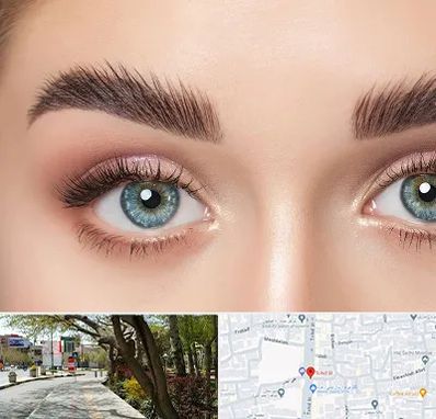 لیفت ابرو در خیابان توحید اصفهان