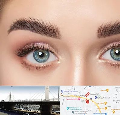 لیفت ابرو در پارک وی 