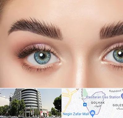 لیفت ابرو در قلهک 