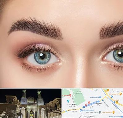 لیفت ابرو در زرگری شیراز