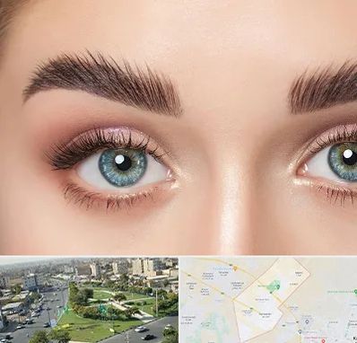 لیفت ابرو در کمال شهر کرج