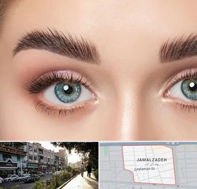 لیفت ابرو در خیابان جمالزاده