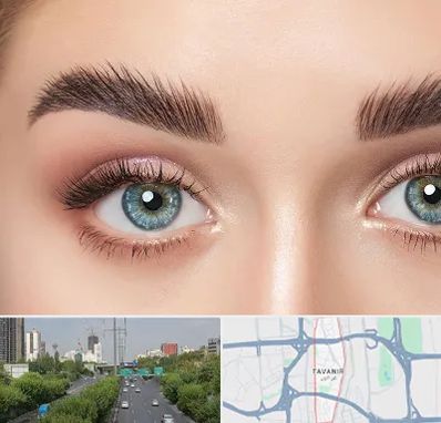 لیفت ابرو در توانیر