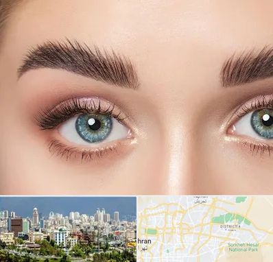 لیفت ابرو در شرق تهران 