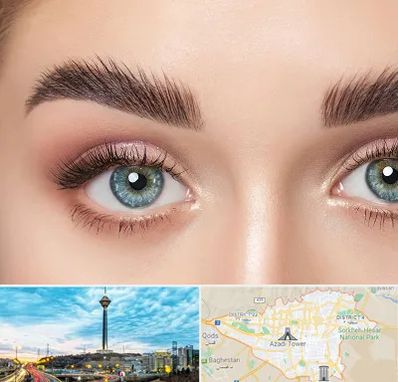 لیفت ابرو در تهران