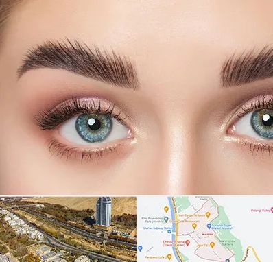 لیفت ابرو در خیابان نیایش شیراز