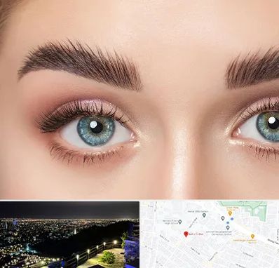 لیفت ابرو در هفت تیر مشهد