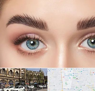 لیفت ابرو در منطقه 11 تهران