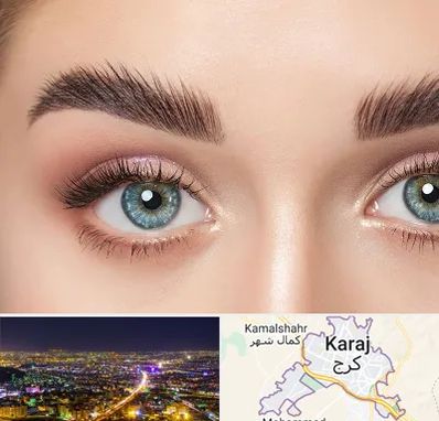 لیفت ابرو در کرج