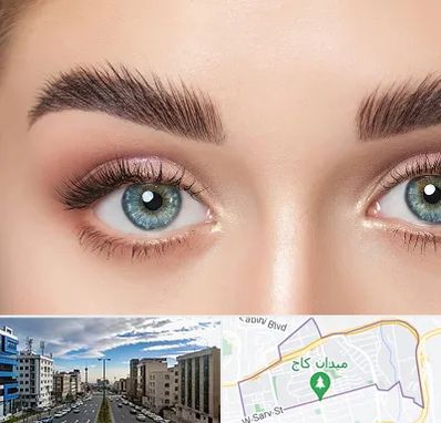 لیفت ابرو در سعادت آباد 