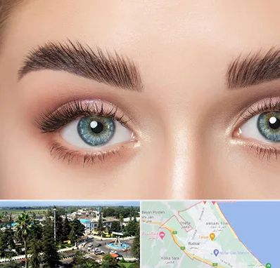 لیفت ابرو در رودسر