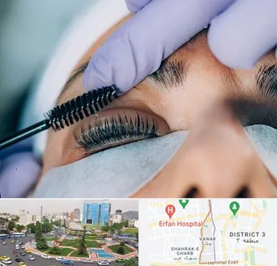 لیفت مژه در ونک 