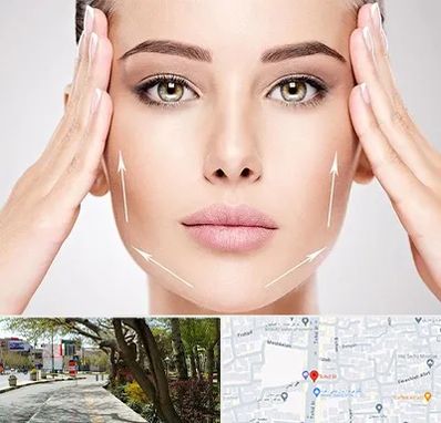 لیفت صورت در خیابان توحید اصفهان