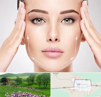 لیفت صورت در سراب