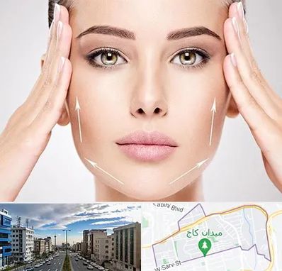 لیفت صورت در سعادت آباد 