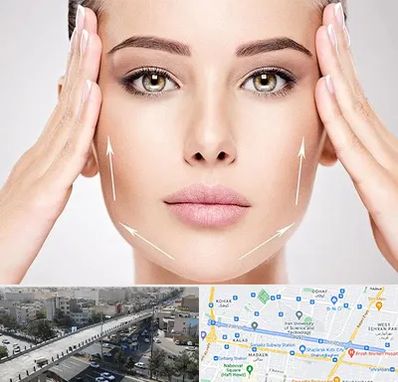 لیفت صورت در فرجام