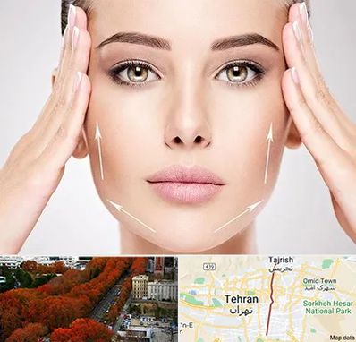 لیفت صورت در ولیعصر 