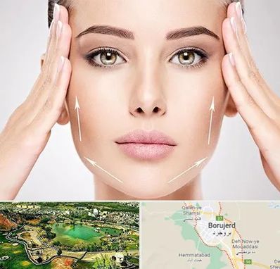 لیفت صورت در بروجرد