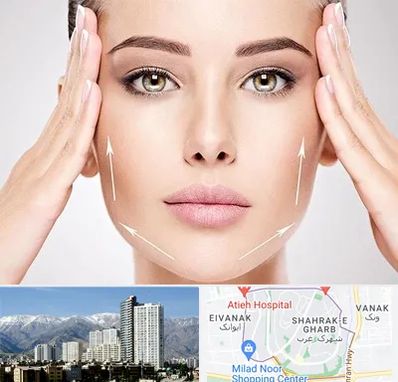 لیفت صورت در شهرک غرب 