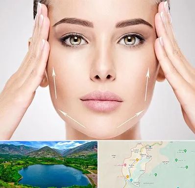 لیفت صورت در رودبار