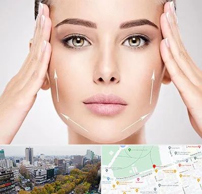 لیفت صورت در بلوار کشاورز