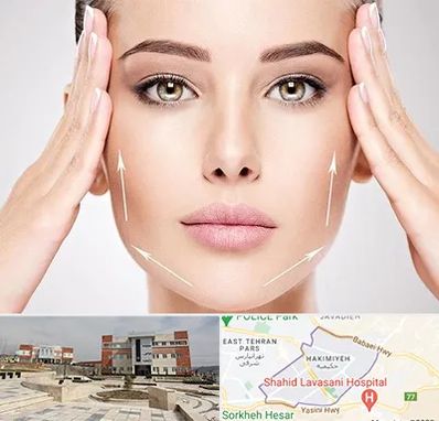 لیفت صورت در حکیمیه 