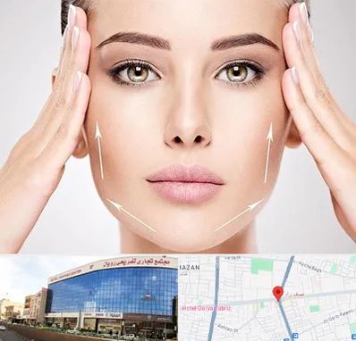 لیفت صورت در نصف راه تبریز