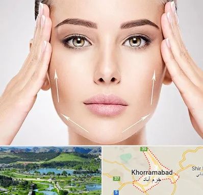 لیفت صورت در خرم آباد