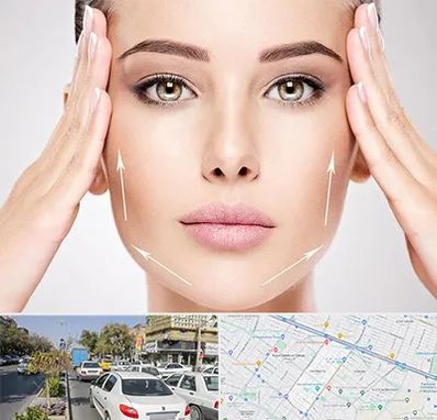 لیفت صورت در مفتح مشهد