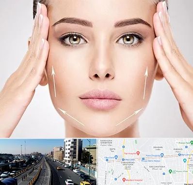 لیفت صورت در پیروزی 