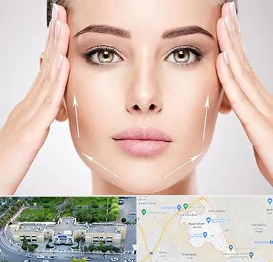 لیفت صورت در نسیم شهر