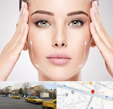 لیفت صورت در شهناز تبریز