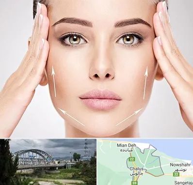 لیفت صورت در چالوس