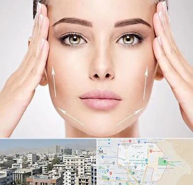 لیفت صورت در منطقه 14 تهران