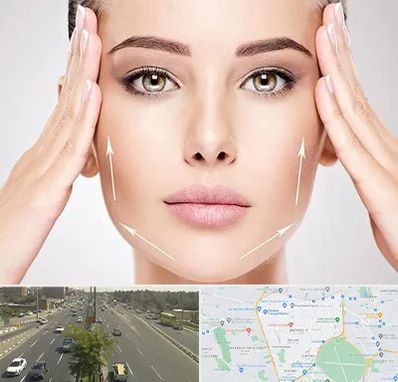 لیفت صورت در منطقه 17 تهران