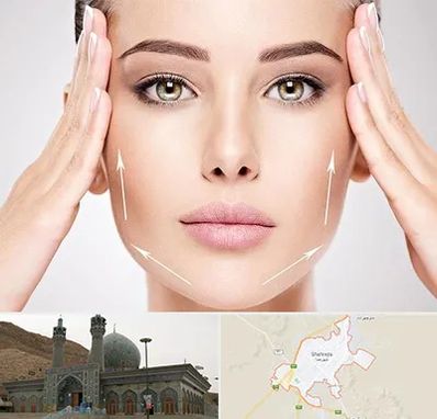 لیفت صورت در شهرضا