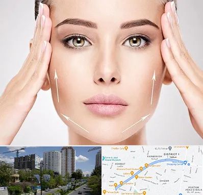 لیفت صورت در اندرزگو