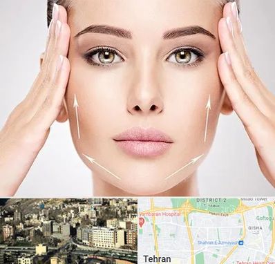 لیفت صورت در مرزداران 