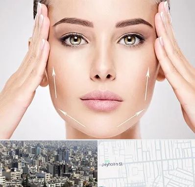 لیفت صورت در جیحون