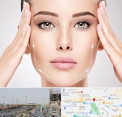 لیفت صورت در بلوار توس مشهد