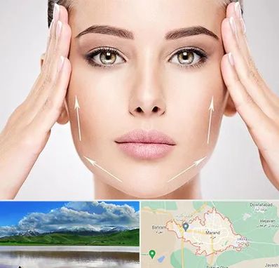 لیفت صورت در مرند