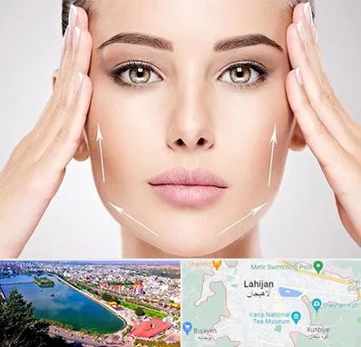 لیفت صورت در لاهیجان