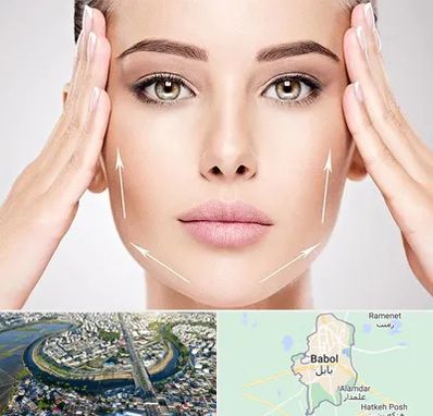 لیفت صورت در بابل