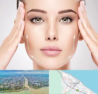 لیفت صورت در تنکابن