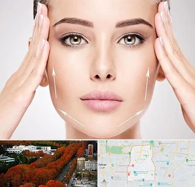 لیفت صورت در منطقه 6 تهران