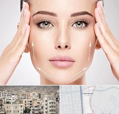 لیفت صورت در اسکندری